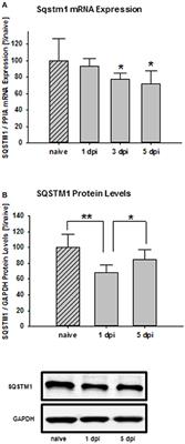 Sequestosome 1 Deficiency Delays, but Does Not Prevent Brain Damage Formation Following Acute Brain Injury in Adult Mice
